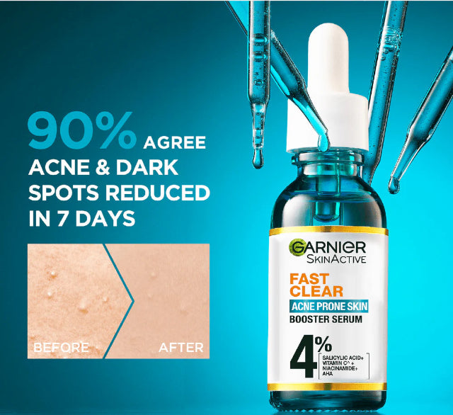 Garnier Serum For Acne Prone Skin